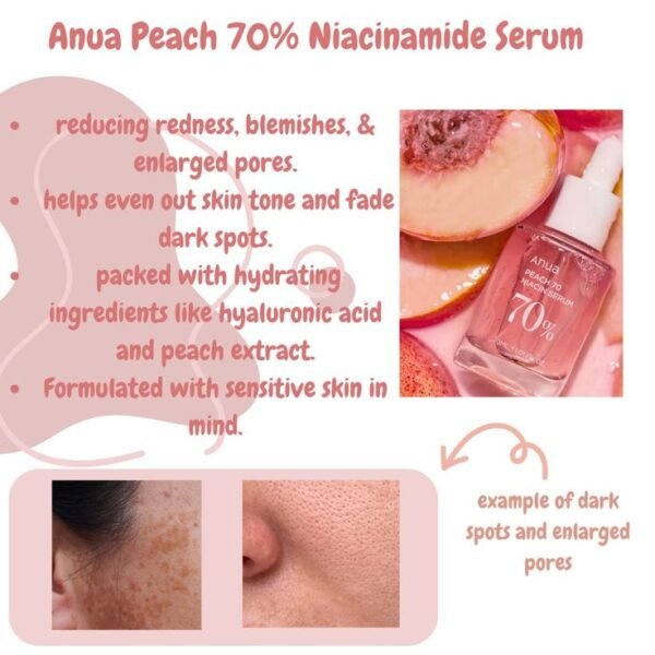 Anua Peach 70% Niacinamide Serum 30ml